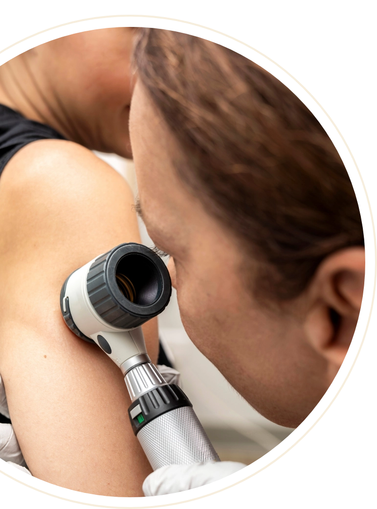 Checking skin cancer