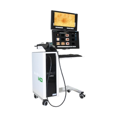 Imaging Machine for Skin Checks